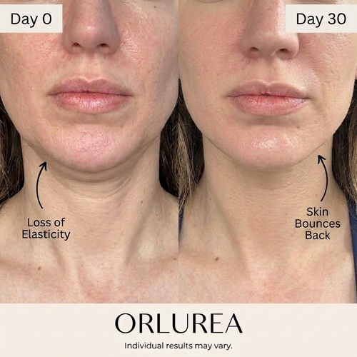 Bounce Ball Serum